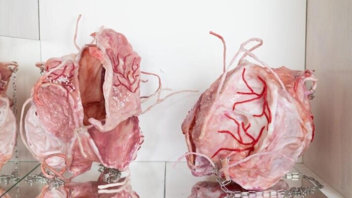 Alina Kleytman, Prosthesis, 2023–2025